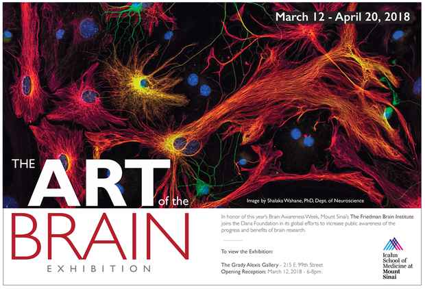 poster for “The Art of the Brain” Exhibition
